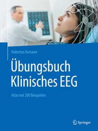 Abbildung von: Übungsbuch Klinisches EEG - Springer