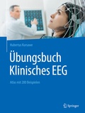 Abbildung von: Übungsbuch Klinisches EEG - Springer