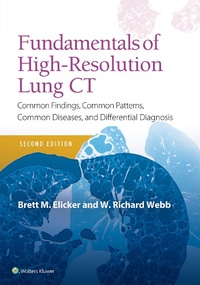 Abbildung von: Fundamentals of High-Resolution Lung CT - Lippincott Williams and Wilkins