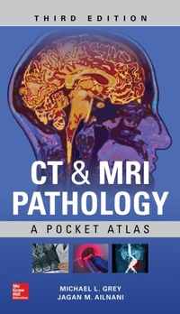 Abbildung von: CT & MRI Pathology: A Pocket Atlas, Third Edition - McGraw Hill LLC