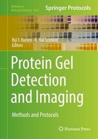 Abbildung von: Protein Gel Detection and Imaging - Humana