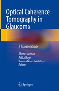 Cover: Optical Coherence Tomography in Glaucoma - Springer