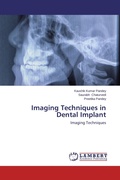 Cover: Imaging Techniques in Dental Implant - LAP Lambert Academic Publishing