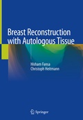 Cover: Breast Reconstruction with Autologous Tissue - Springer
