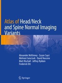 Abbildung von: Atlas of Head/Neck and Spine Normal Imaging Variants - Springer