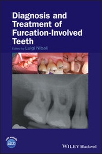 Enlarge image Cover: Diagnosis and Treatment of Furcation-Involved Teeth - Wiley