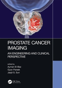Abbildung von: Prostate Cancer Imaging - CRC Press