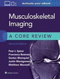 Enlarge image Cover: Musculoskeletal Imaging: A Core Review - WOLTERS KLUWER HEALTH