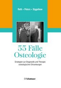 Abbildung von: 55 Fälle Osteologie - Thieme