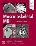 Cover: Musculoskeletal MRI E-Book - Elsevier