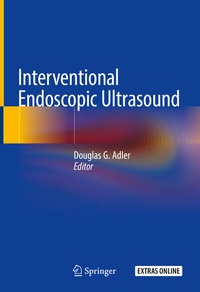Abbildung von: Interventional Endoscopic Ultrasound - Springer