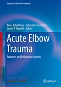 Cover: Acute Elbow Trauma - Springer