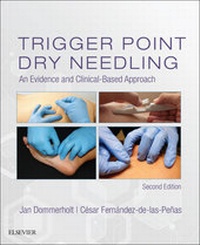 Abbildung von: Trigger Point Dry Needling E-Book - Elsevier