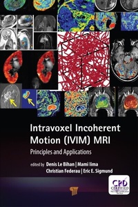 Abbildung von: Intravoxel Incoherent Motion (IVIM) MRI - Routledge Cavendish