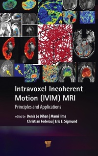 Enlarge image Cover: Intravoxel Incoherent Motion (IVIM) MRI - Pan Stanford Publishing Pte Ltd
