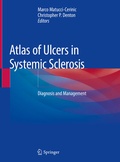 Cover: Atlas of Ulcers in Systemic Sclerosis - Springer