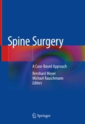 Cover: Spine Surgery - Springer