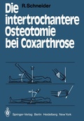 Cover: Die intertrochantere Osteotomie bei Coxarthrose - Springer