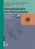 Cover: Dermatoskopie von Hauttumoren - Steinkopff