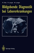 Cover: Bildgebende Diagnostik bei Lebererkrankungen - Springer