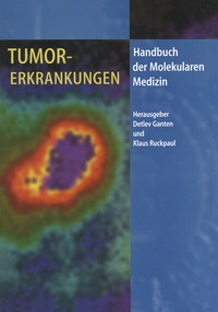 Abbildung von: Tumorerkrankungen - Springer