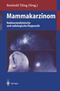 Bild vergrößern Bild: Mammakarzinom - Springer