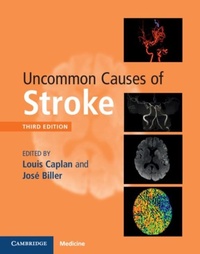 Abbildung von: Uncommon Causes of Stroke - Cambridge University Press
