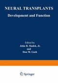 Bild: Neural Transplants - Springer