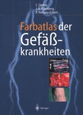 Bild: Farbatlas der Gef&auml;&szlig;krankheiten - Springer