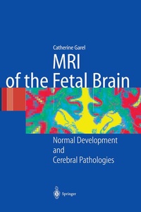 Abbildung von: MRI of the Fetal Brain - Springer