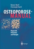 Cover: Osteoporose-Manual - Springer