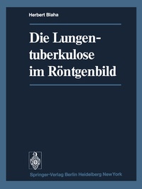 Abbildung von: Die Lungentuberkulose im Röntgenbild - Springer