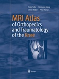 Cover: MRI Atlas of Orthopedics and Traumatology of the Knee - Springer