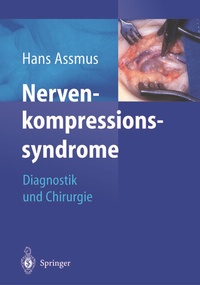 Abbildung von: Nerven-kompressions-syndrome - Springer