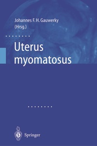 Abbildung von: Uterus myomatosus - Springer