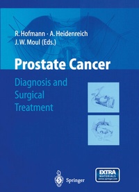 Enlarge image Cover: Prostate Cancer - Springer