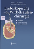 Cover: Endoskopische Wirbels&auml;ulenchirurgie - Springer