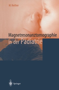 Abbildung von: Magnetresonanztomographie in der Pädiatrie - Springer
