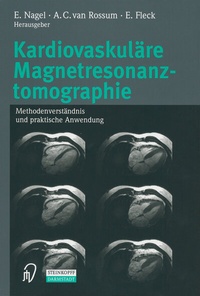 Abbildung von: Kardiovaskuläre Magnetresonanztomographie - Steinkopff
