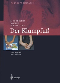 Abbildung von: Der Klumpfuss - Springer