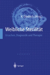 Abbildung von: Weibliche Sterilität - Springer