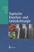 Cover: Septische Knochen-und Gelenkchirurgie - Springer
