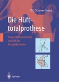 Cover: Die H&uuml;fttotalprothese - Springer