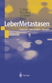 Abbildung von: LeberMetastasen - Springer