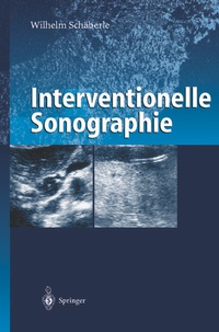 Abbildung von: Interventionelle Sonographie - Springer