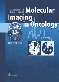Abbildung von: Molecular Imaging in Oncology - Springer