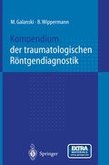 Cover: Kompendium der traumatologischen R&ouml;ntgendiagnostik - Springer
