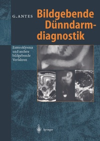 Abbildung von: Bildgebende Dünndarmdiagnostik - Springer
