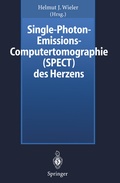 Bild: Single-Photon-Emissions-Computertomographie (SPECT) des Herzens - Springer