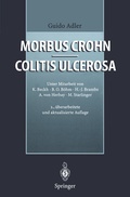 Cover: Morbus Crohn - Colitis ulcerosa - Springer